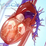 Cardiovascular Cell Therapy Research Network