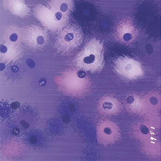 1951 Henrietta Lacks